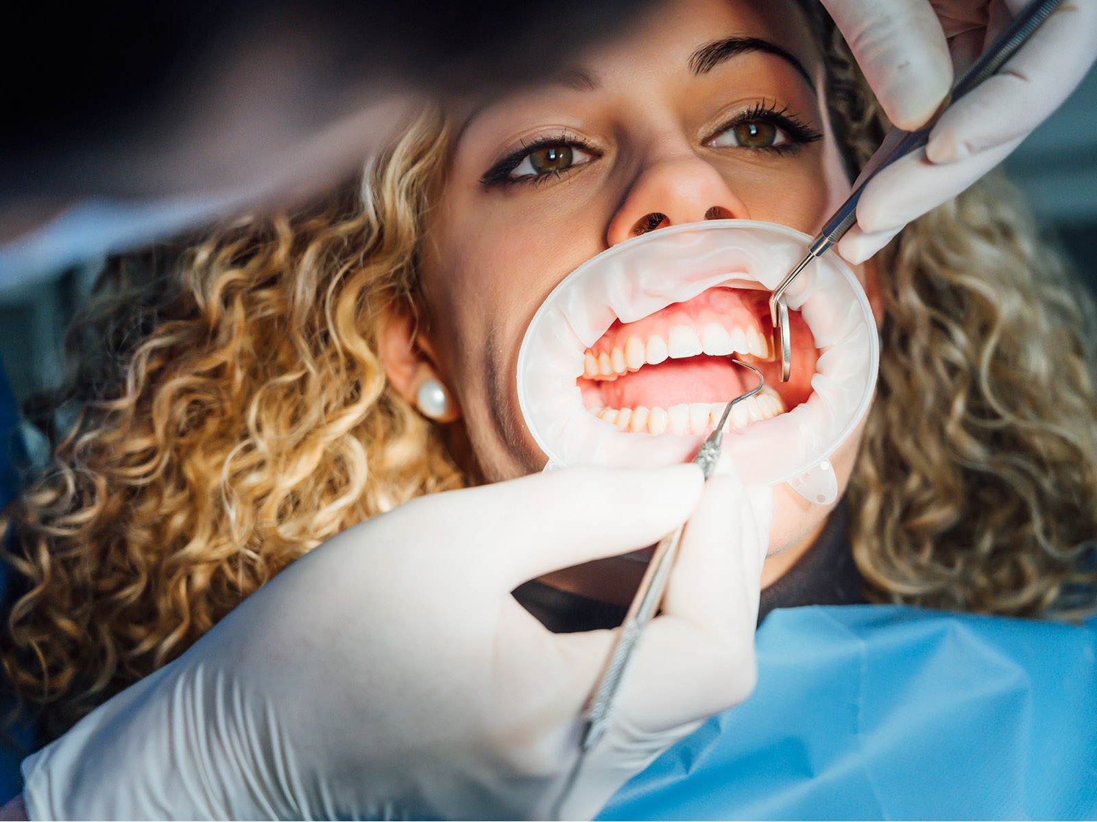 dental scaling & root planing in burlington​