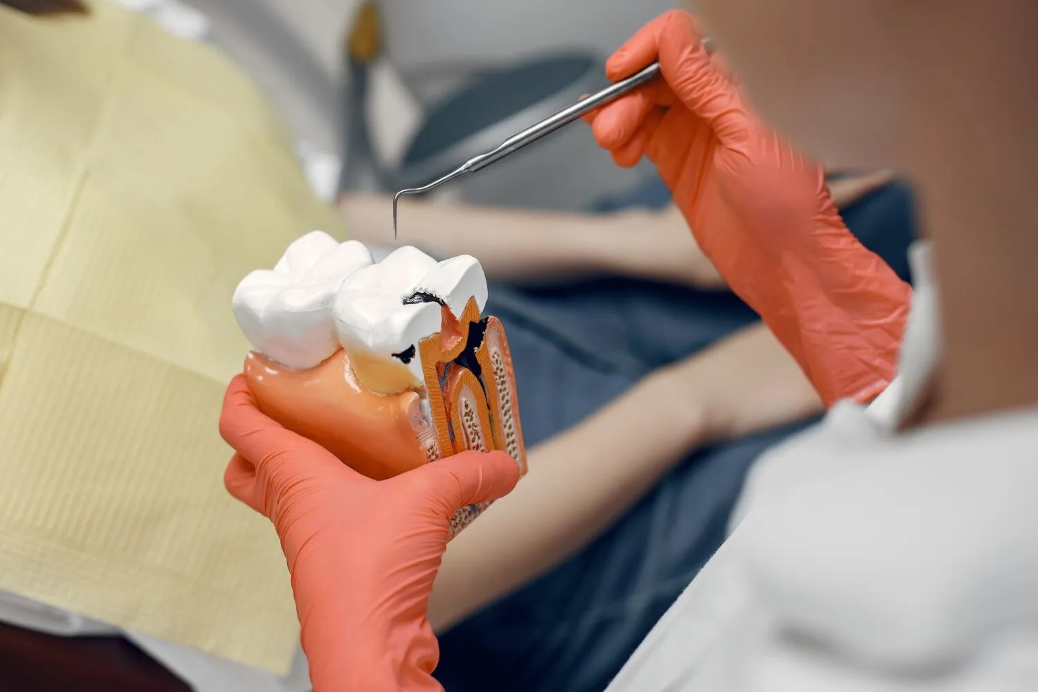 root canal treatment burlington
