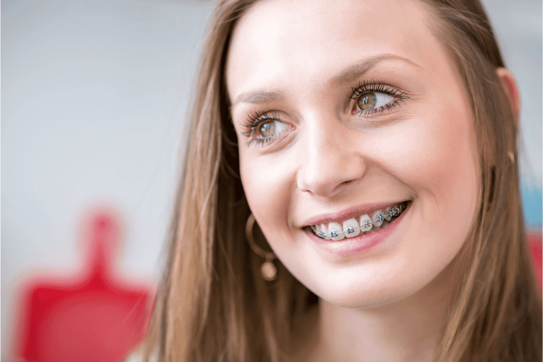 conventional braces near you
